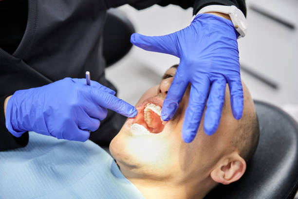 Best Emergency Dentist for Knocked-Out Tooth in Erath, LA